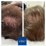 Polynucleotides - Skin Booster