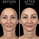 Polynucleotides - Skin Booster