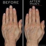 Polynucleotides - Skin Booster