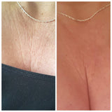 Sunekos Single Treatment