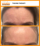 Thavma Anti-Wrinkle Facial