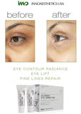 Ultimate Eye Corrector Peel (Package)