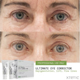 Ultimate Eye Corrector Peel (Package)