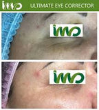 Ultimate Eye Corrector Peel (Package)