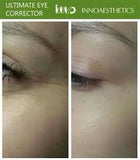 Ultimate Eye Corrector Peel (Package)