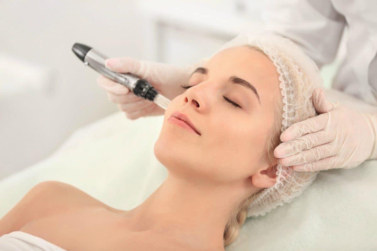 Microneedling With LED Light Elite Aesthetic Clinic