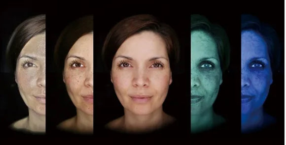 Optera Skin OPATRA Skin Analysis – Elite Aesthetic Clinic