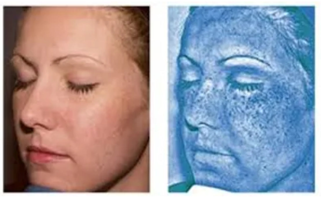 Optera Skin OPATRA Skin Analysis – Elite Aesthetic Clinic