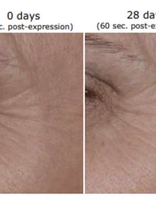 Infinite youth Tx Boost Serum