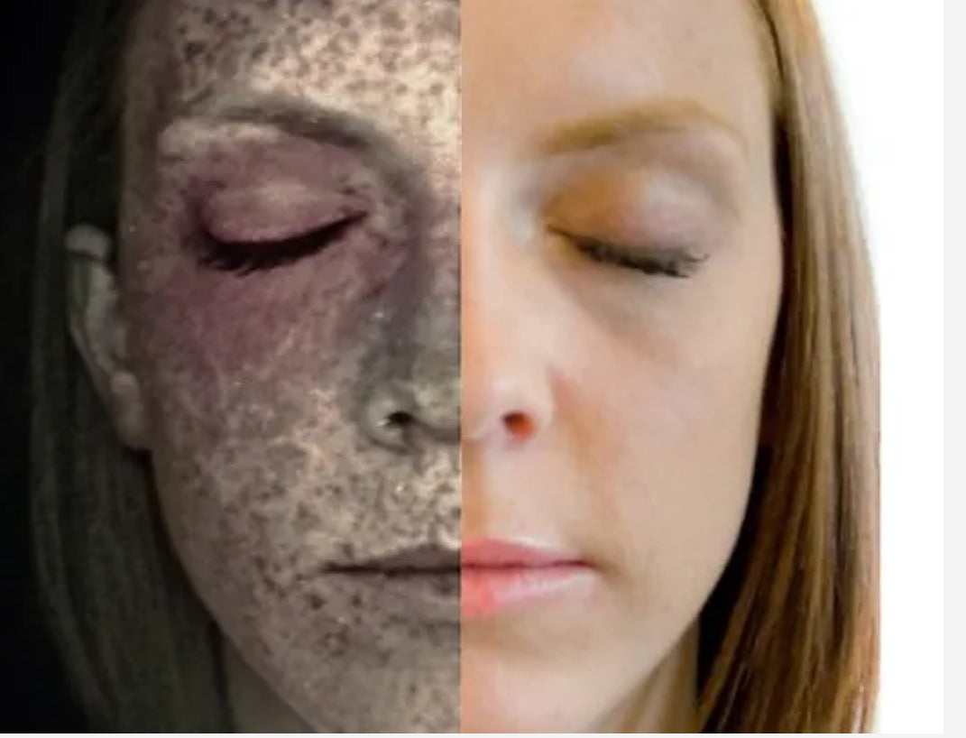 Optera Skin OPATRA Skin Analysis – Elite Aesthetic Clinic