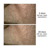 Infinite youth Tx Boost Serum