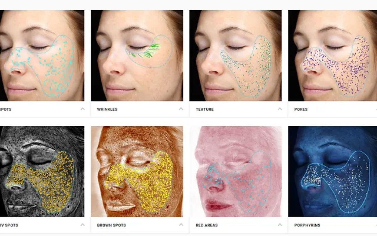 Optera Skin OPATRA Skin Analysis – Elite Aesthetic Clinic