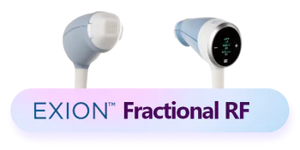 Exion RF Microneedling