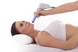 Exilis Ultra Lower Face Package of 6