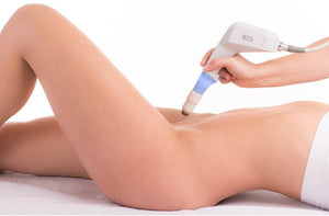 Exilis Ultra Vagina/Libia Package of 3