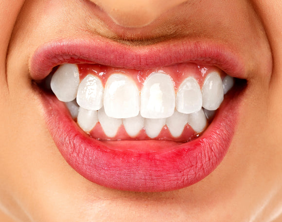 Bruxism.      This Treatment cannot be booked without a prior  ANTI WRINKLE INJECTION CONSULTATION
