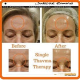 Thavma Anti-Wrinkle Facial