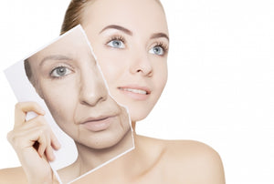 Meline Chemical Peel
